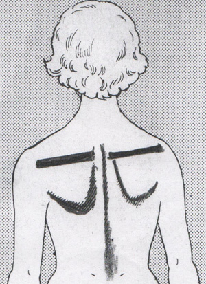 左右の肩の高さの違い